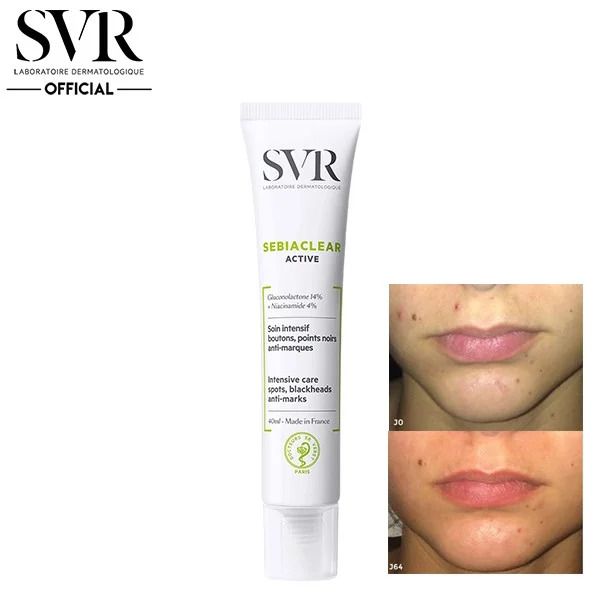SVR Sebiaclear Active là sản phẩm chăm sóc da mụn được tin dùng