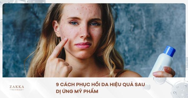 9 Cách Phục Hồi Da Hiệu Quả Sau Dị Ứng Mỹ Phẩm