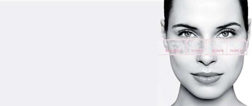 Eucerin White Therapy banner