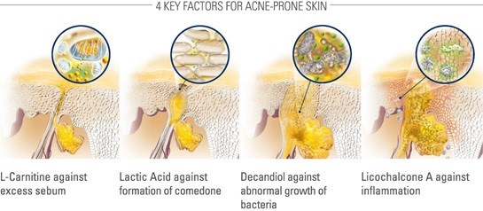 Eucerin Dermo Purifyer Toner 3