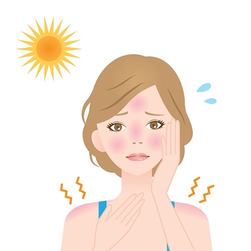 5 cách khắc phục da bị cháy nắng tại nhà