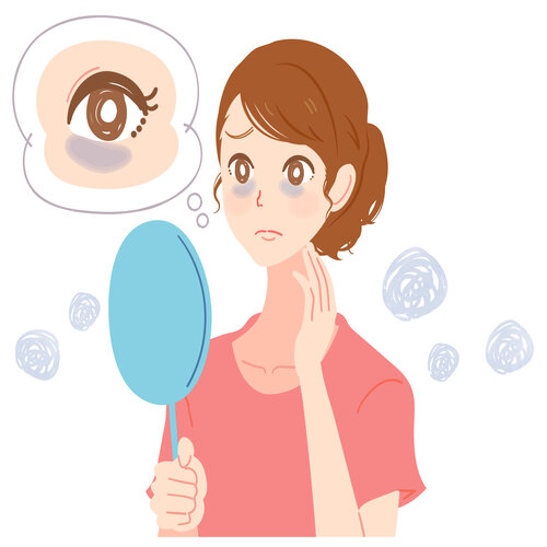 7 cách trị quầng thâm mắt đơn giản và hiệu quả tại nhà