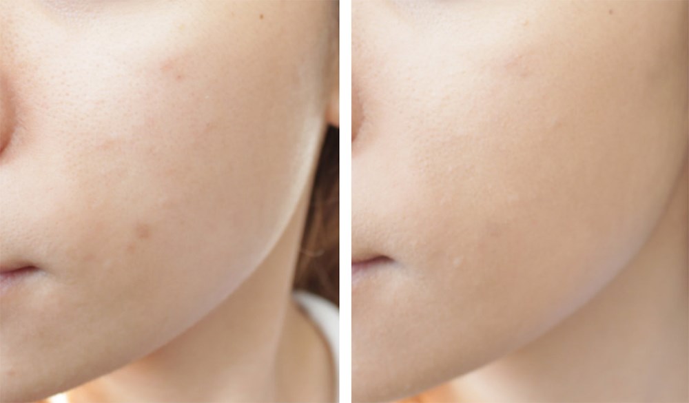review kem nen Maybelline Fit Me Matte Poreless hinh anh