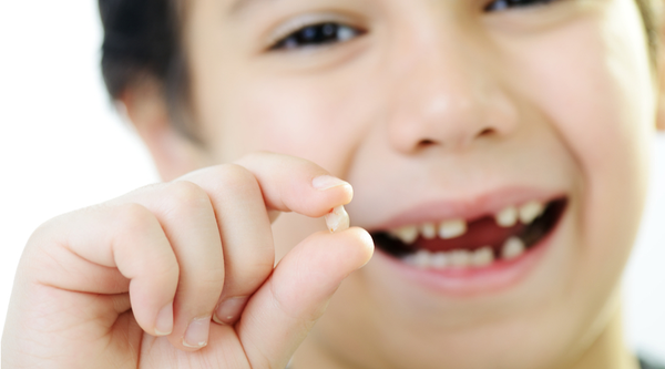Cần làm gì khi trẻ nhỏ bị mẻ răng?
