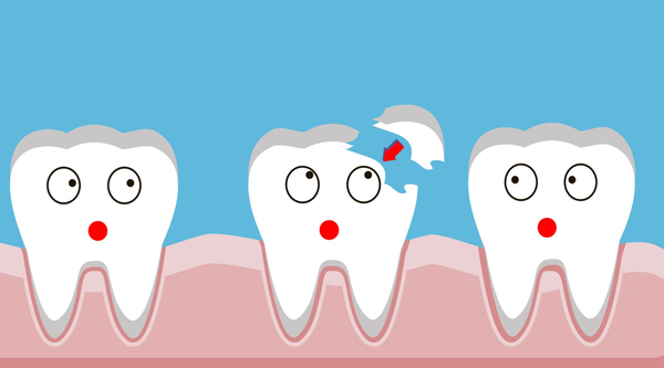 Cần làm gì khi răng bị nứt gãy?