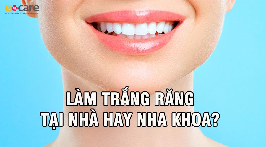Làm trắng răng tại nhà hay tại nha khoa?