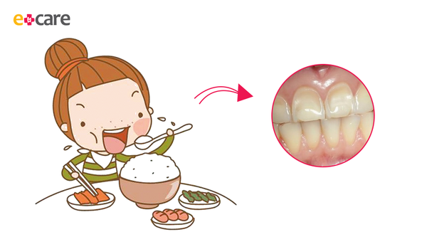 quan hệ giữa răng miệng và sức khỏe