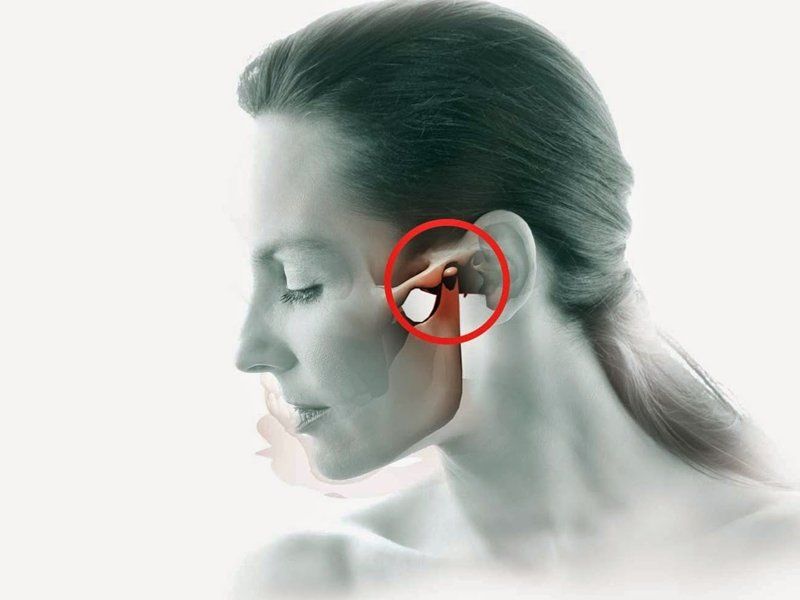 Chữa Nhức Thái Dương Bằng Diện Chẩn