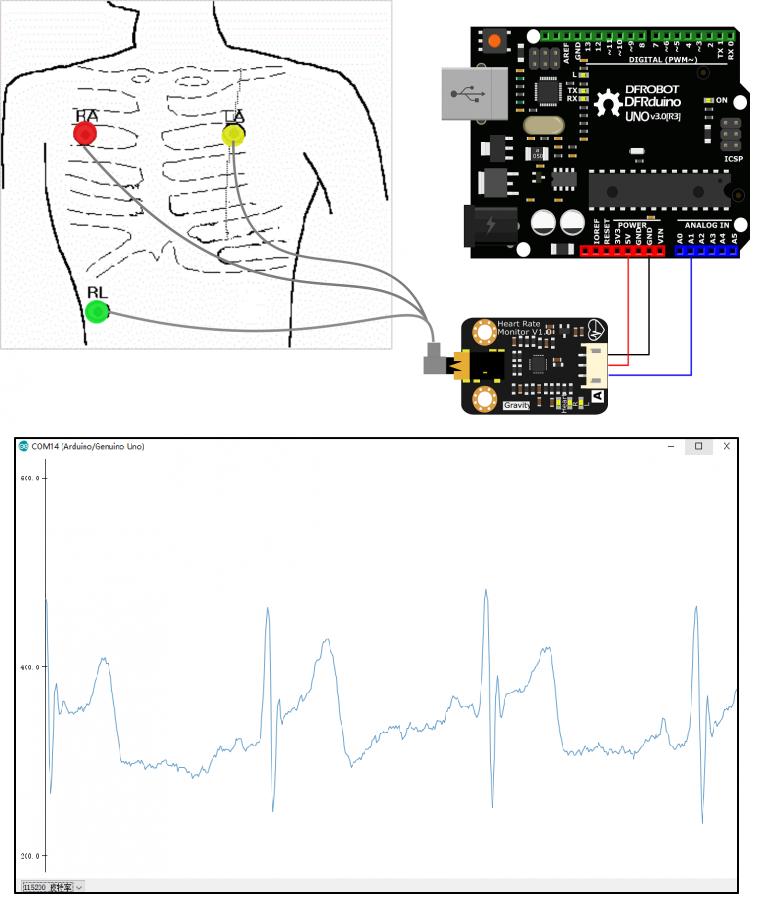 Cảm biến nhịp tim DFRobot Gravity: Analog ECG Heart Rate Sensor