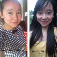 thuoc tri mun