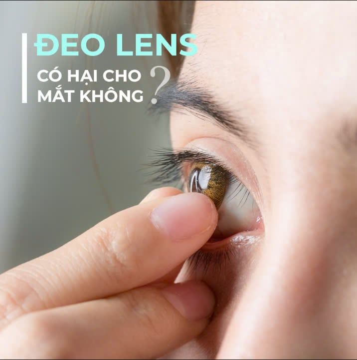 ĐEO LENS CÓ HẠI CHO MẮT KHÔNG? CÁCH VỆ SINH LENS ĐÚNG VÀ AN TOÀN?