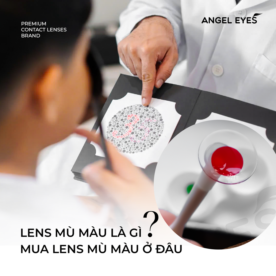 Kính áp tròng mù màu là gì? Mua kính áp tròng mù màu ở đâu?