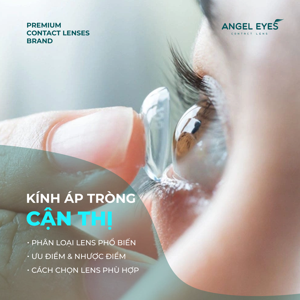 Kính Áp Tròng Cận Thị: Phân Loại, Ưu Nhược Điểm & Cách Chọn Lens Phù Hợp Nhất