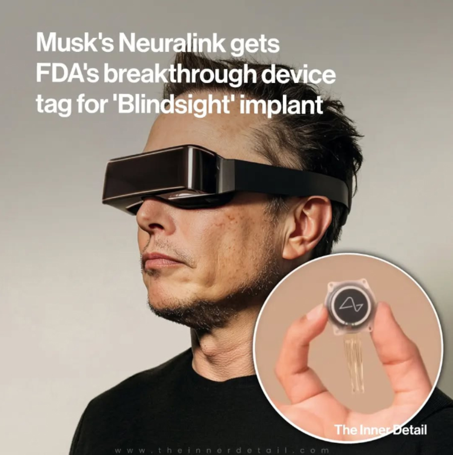 Công Nghệ Của Elon Musk Giúp Xóa Mù - Chip BlindSight Đang Làm Chấn Động Giới Khoa Học - mucsothi.com.vn