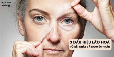 Dấu hiệu lão hoá rõ rệt nhất & NGUYÊN NHÂN