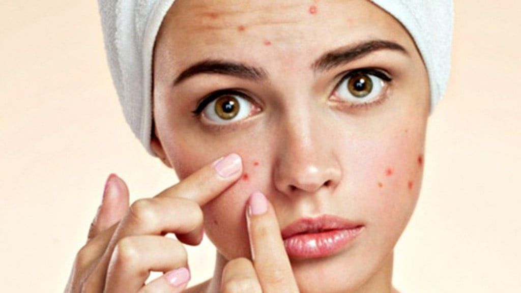 Mỗi ngày chỉ tốn 2 nghìn đồng mụn sẽ biến mất trong 7 ngày !