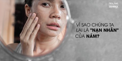 VÌ SAO CHÚNG TA LÀ "NẠN NHÂN" CỦA NÁM?