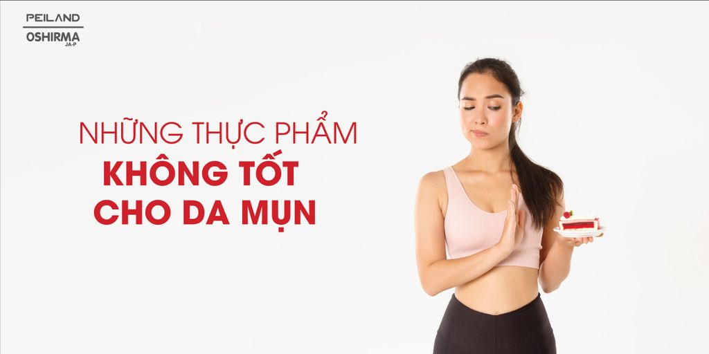 NHỮNG THỰC PHẨM KHÔNG TỐT CHO DA MỤN