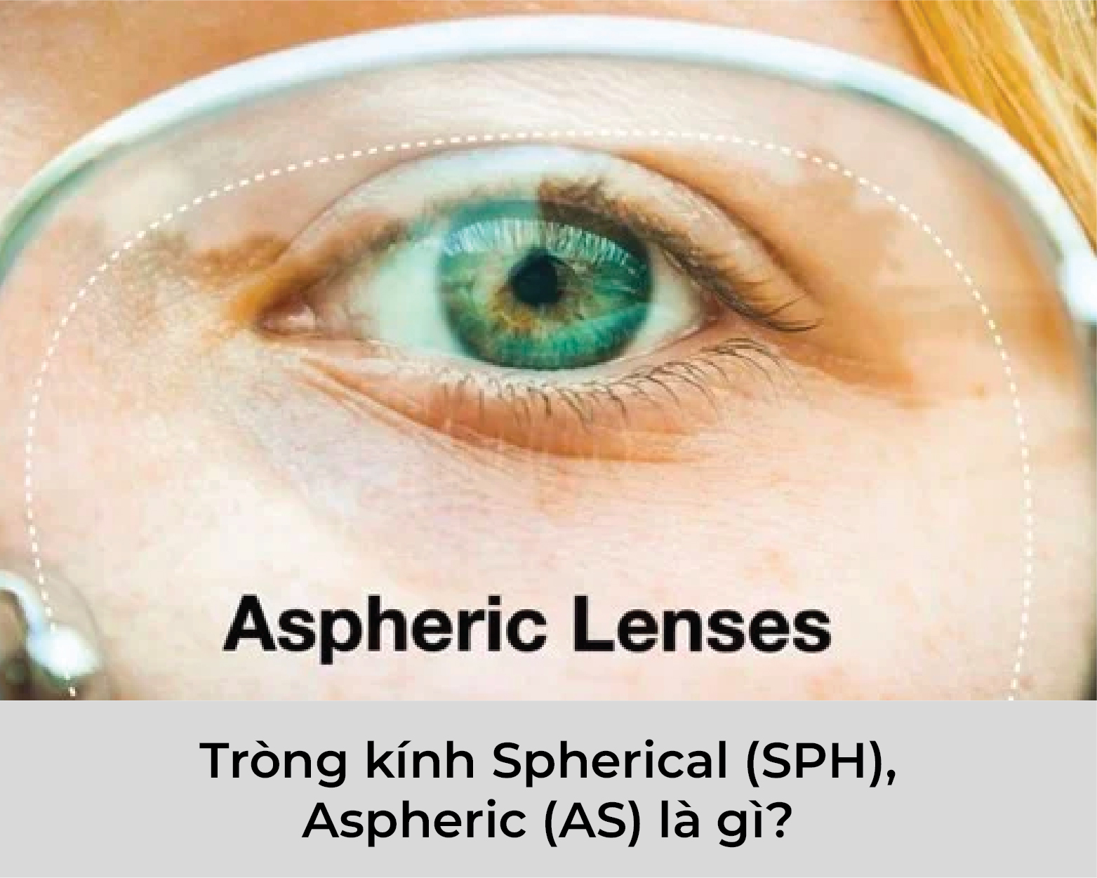 Tròng kính Spherical (SPH), Aspheric (AS) là gì?