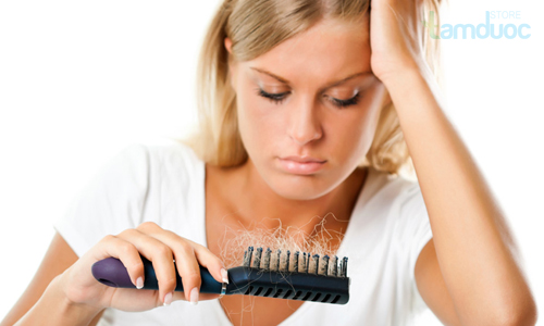 Rụng tóc sau sinh và cách điều trị