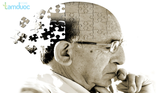 Tìm hiểu về căn bệnh Alzheimer?