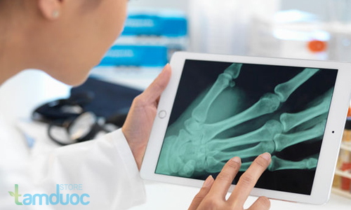 Viêm khớp và những điều bạn nên biết