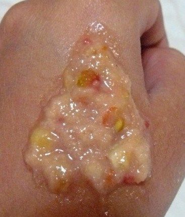 Làm trắng da hoàn hảo từ Táo