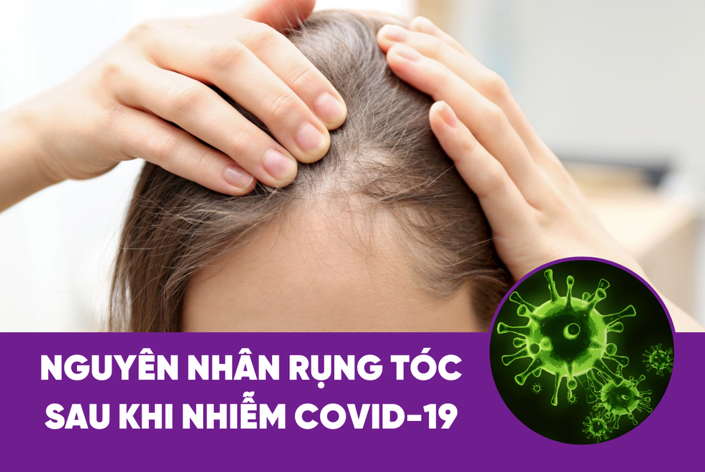 Trị Rụng Tóc Hậu Covid Tại Nhà Hiệu Quả - Tiết Kiệm