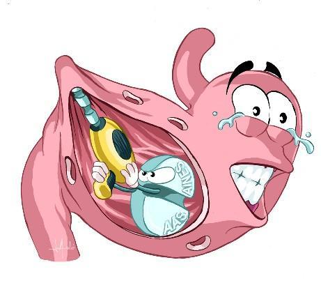 Đau Dạ Dày Đến Mấy Cũng Chỉ Cần Dùng Cây Này Là Khỏi Ngay Lập Tức