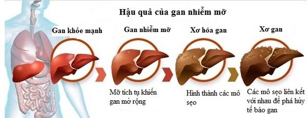 hậu quả của gan nhiễm mỡ