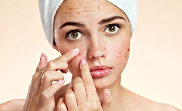 4 cách 'thổi bay' mụn trứng cá ai không biết sẽ phải tiếc hùi hụi