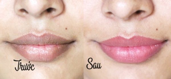 Môi thâm đen xì do bẩm sinh cũng hồng hào, căng mọng nhờ 1 nhúm đường