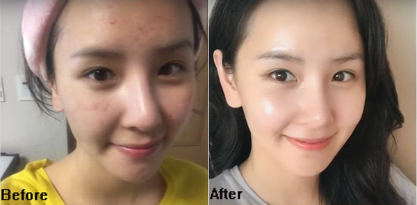 Con gái Hàn da sạch mụn, bóng mịn là nhờ có công thức pha toner với nước để rửa mặt