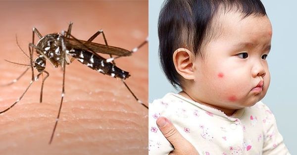 Cảnh báo trẻ sơ sinh bị muỗi đốt gây nhiều hiểm họa khôn lường!!!