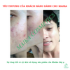 Chia sẻ yêu thương của khách hàng