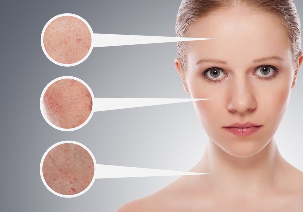 Những nguyên nhân hình thành nên mụn và các cách điều trị cơ bản