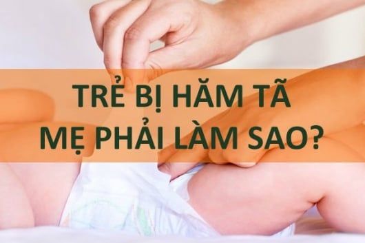 7 CÁCH TRỊ HĂM TÃ NHANH CHÓNG, HIỆU QUẢ NGAY TẠI NHÀ