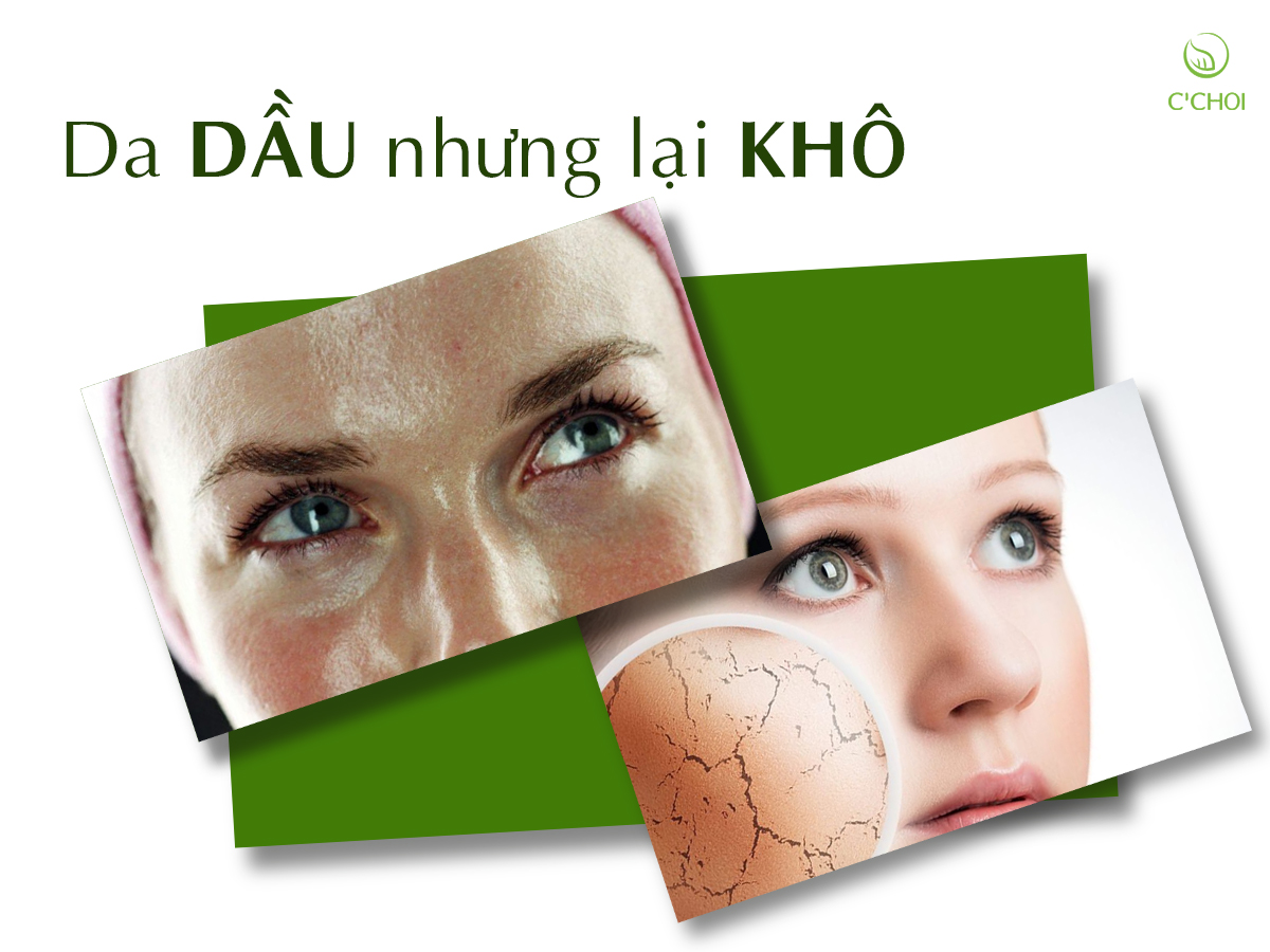 Bật Mí Làn Da Dầu Mà Lại Khô