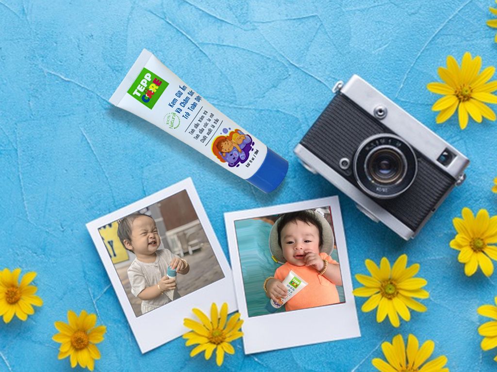 7 Yếu Tố Làm Nên Sự Khác Biệt Của Kem Giữ Ấm và Chăm Sóc Trẻ Toàn Diện Tepp Care