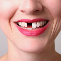 bridgework or dental implant what is better for one missing teeth