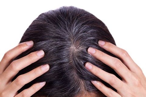 Top 5 cách hỗ trợ trị tóc bạc hiệu quả tại nhà bạn nên biết