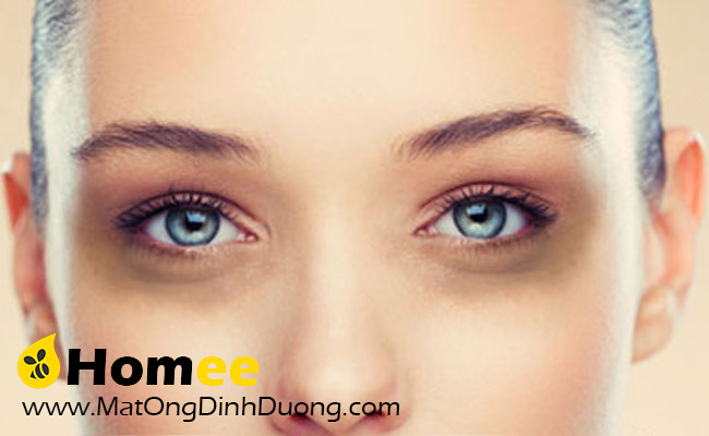 LÀM ĐẸP BẰNG MẬT ONG: TRỊ THÂM QUẦNG MẮT BẰNG MẬT ONG VÀ CAM
