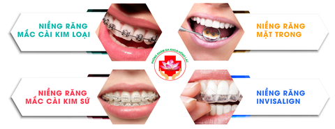 NIỀNG RĂNG THẨM MỸ