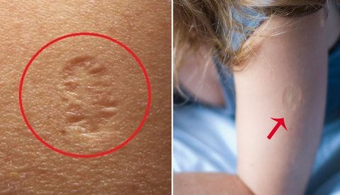 Lý do vì sao tỉ lệ tử vong do Covid 19 ở Việt Nam bằng 0?