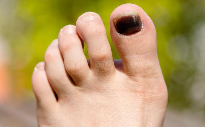 Đau mắt: Nguyên nhân, triệu chứng và bệnh thường gặp