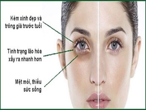 Tổng Hợp Sản Phẩm Đặc Trị Thâm Quầng và Nếp Nhăn Mắt an toàn hiệu quả tại nhà
