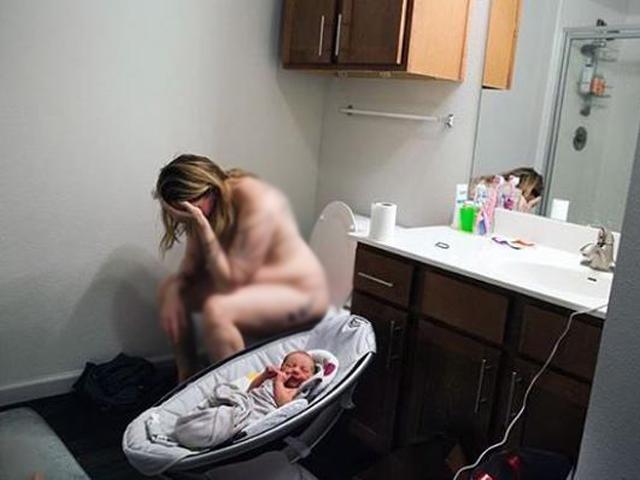 Có thật sinh mổ gây chứng 
