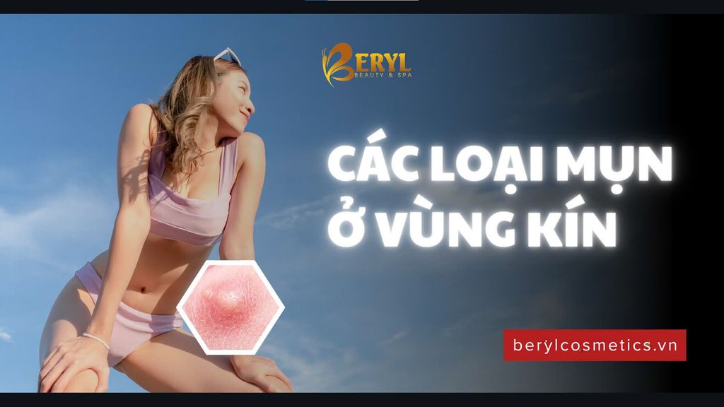 Các loại mụn ở vùng kín
