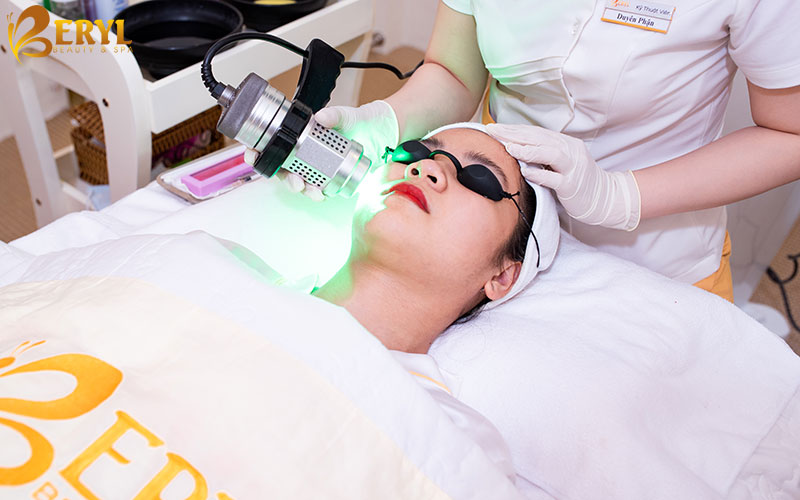 Điều trị mụn bằng công nghệ cao Green Laser.