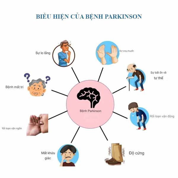 Bệnh Parkinson